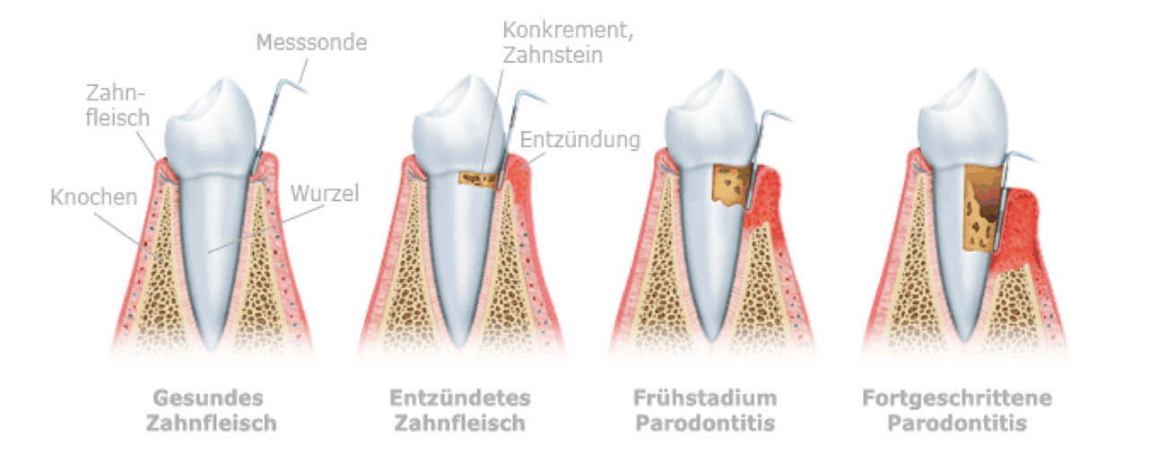 image_text_parodontologie